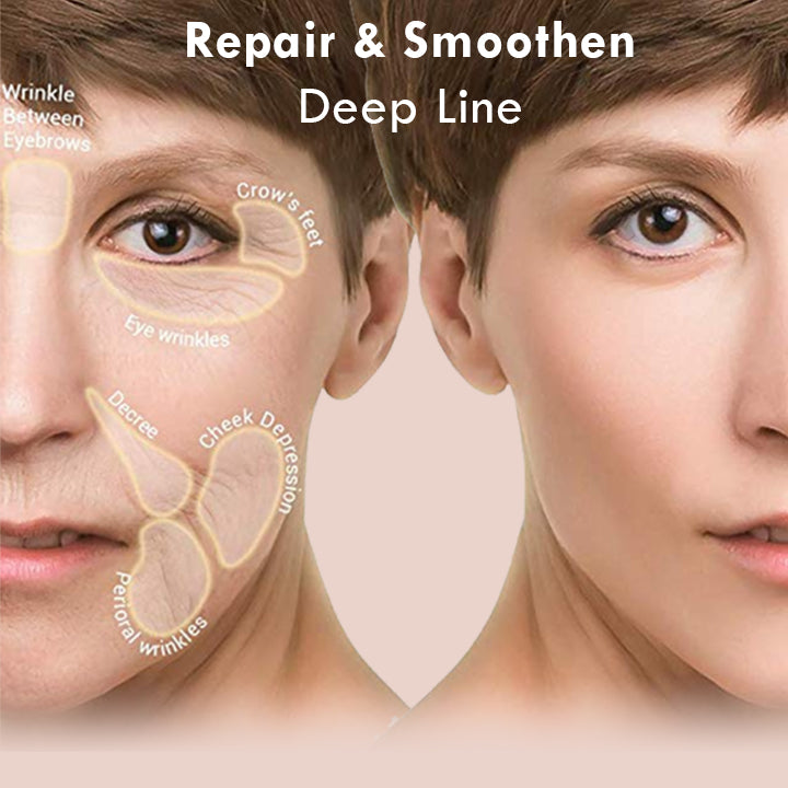 Six Peptides Anti Wrinkle Serum