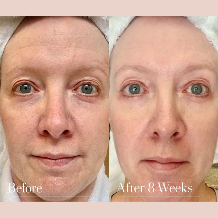 Six Peptides Anti Wrinkle Serum