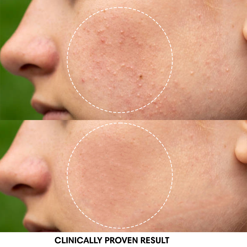 Turmeric Brightening Mask