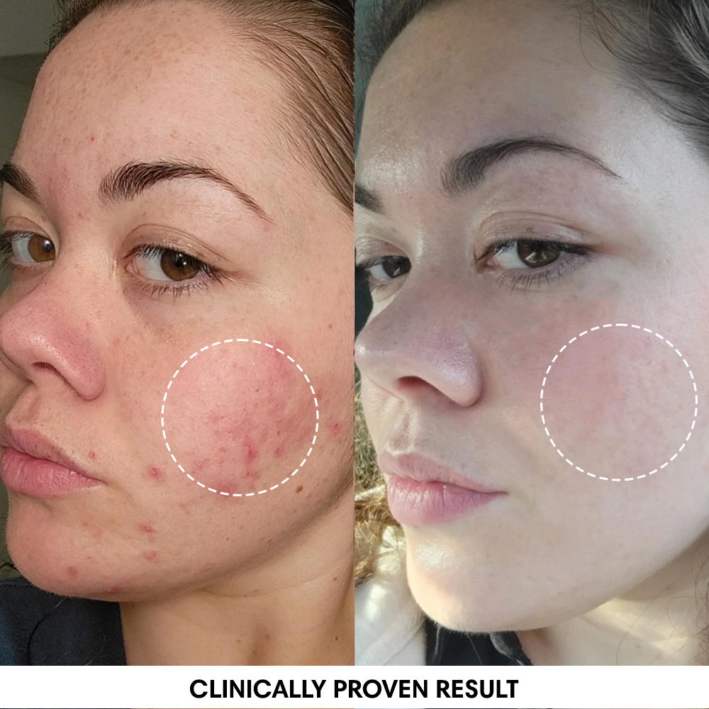 Turmeric Brightening Soap