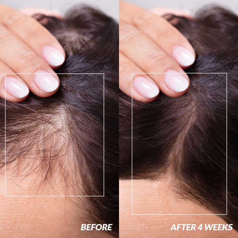 Castor Oil Multi Hair Growth Serum
