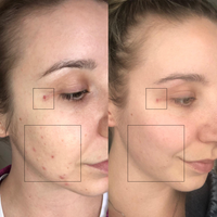 Turmeric Dark Spot Corrector Serum
